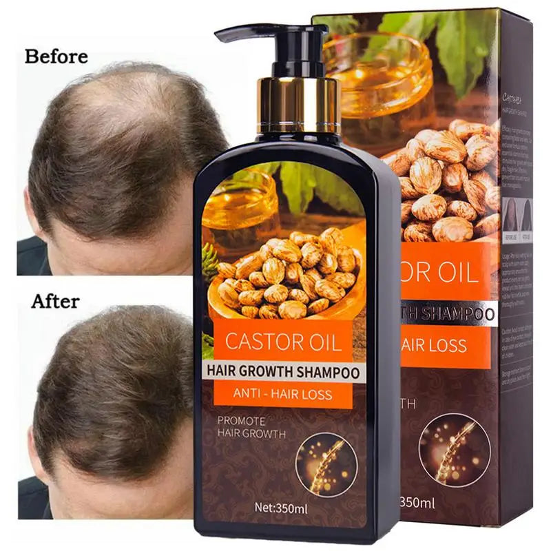 Hair Growth Castor Oil Shampoo Anti Hair Loss Shampoo Hair Care Products Hair Regrowth Treatment Conditioner Thickener Men Women ShopOnlyDeal