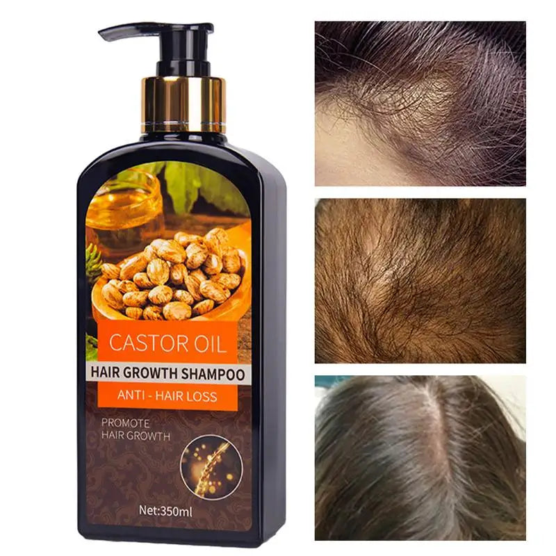 Hair Growth Castor Oil Shampoo Anti Hair Loss Shampoo Hair Care Products Hair Regrowth Treatment Conditioner Thickener Men Women ShopOnlyDeal