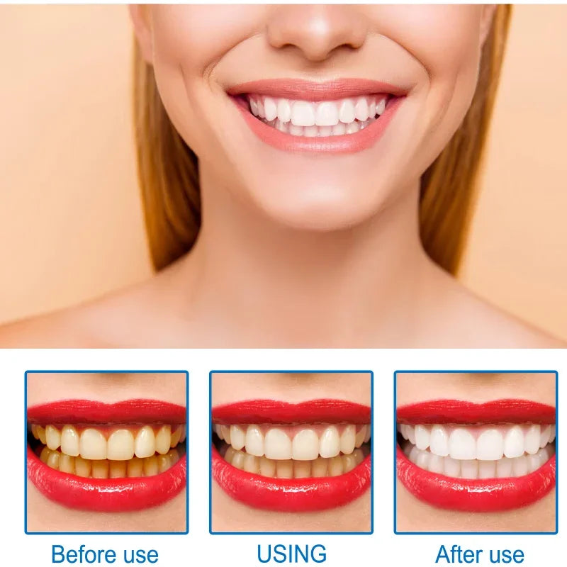 Teeth Whitening Essence Remove Against Dental Caries Plaque Dirt Serum Fresh Breath Oral Hygiene Dental Tooth Cleaning Tools Eelhoe Skincare Store