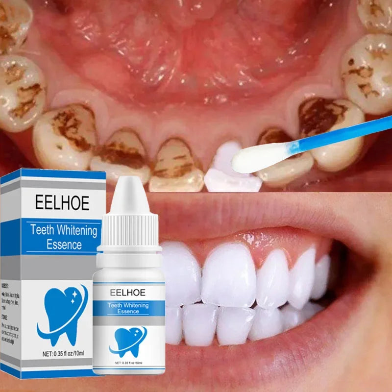 Teeth Whitening Essence Remove Against Dental Caries Plaque Dirt Serum Fresh Breath Oral Hygiene Dental Tooth Cleaning Tools Eelhoe Skincare Store