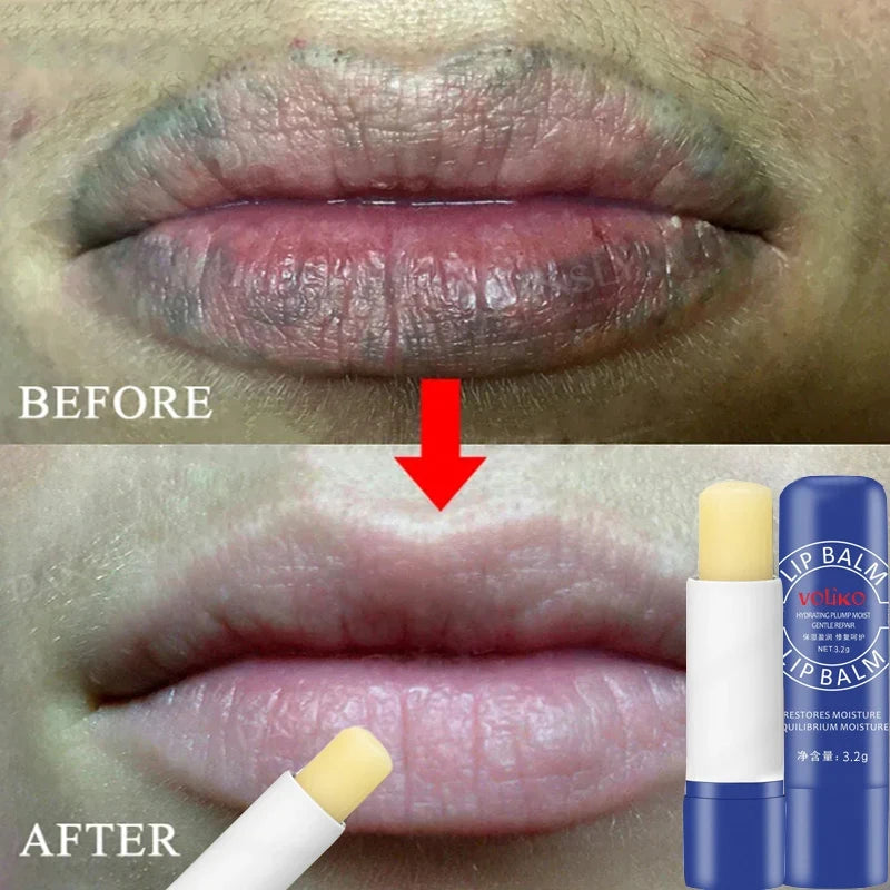 Lip Balm Remove Dark Lighten Melanin Lip Mask Fade Lip Line Brighten Exfoliating Moisturize Dead Skin Repair Lip Care Products ShopOnlyDeal