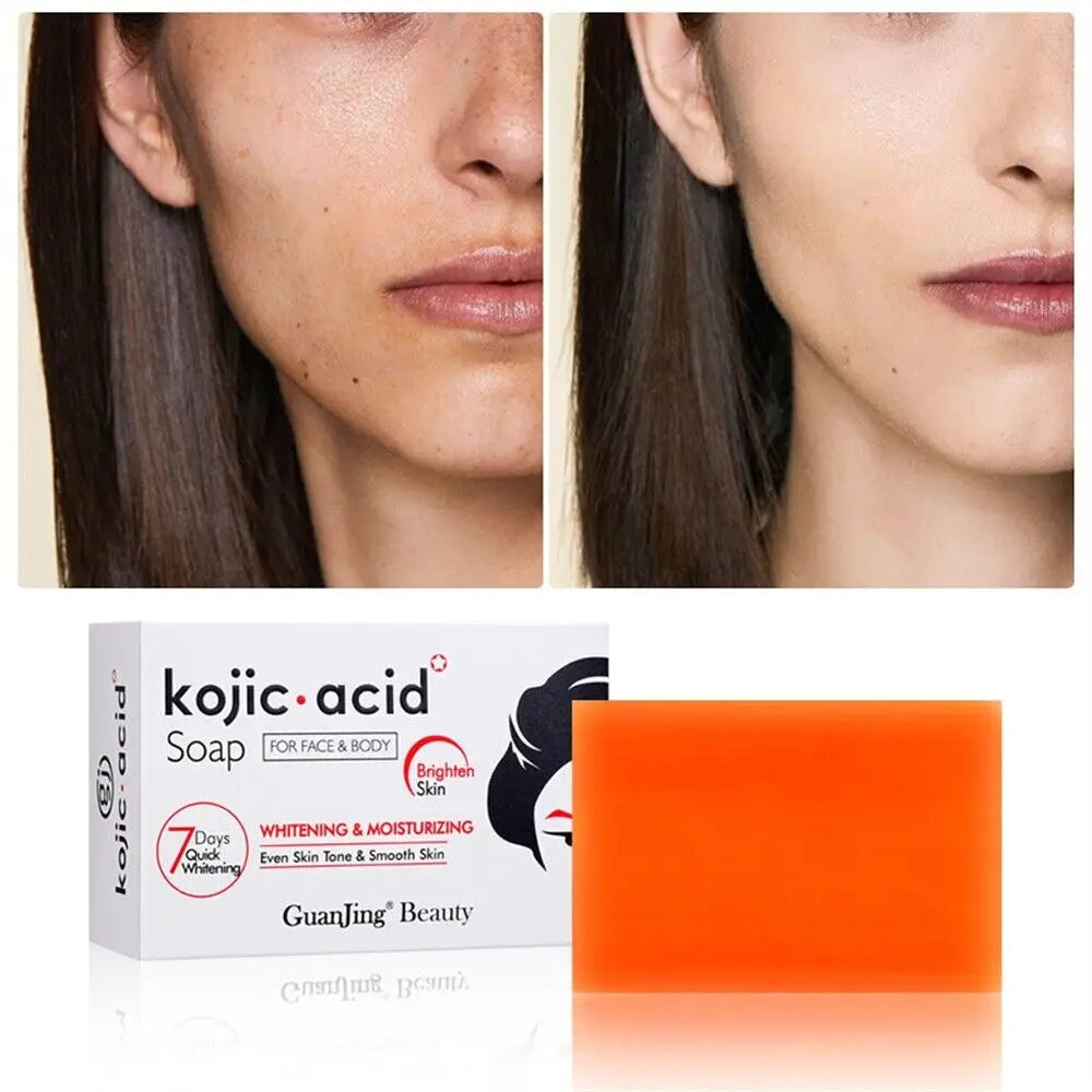 Genuine Kojic Acid Soap Original Whitening Soap Remove Black Facial Soap Handmade Bleaching Acid Glycerin Deep Cleaning Skin ShopOnlyDeal