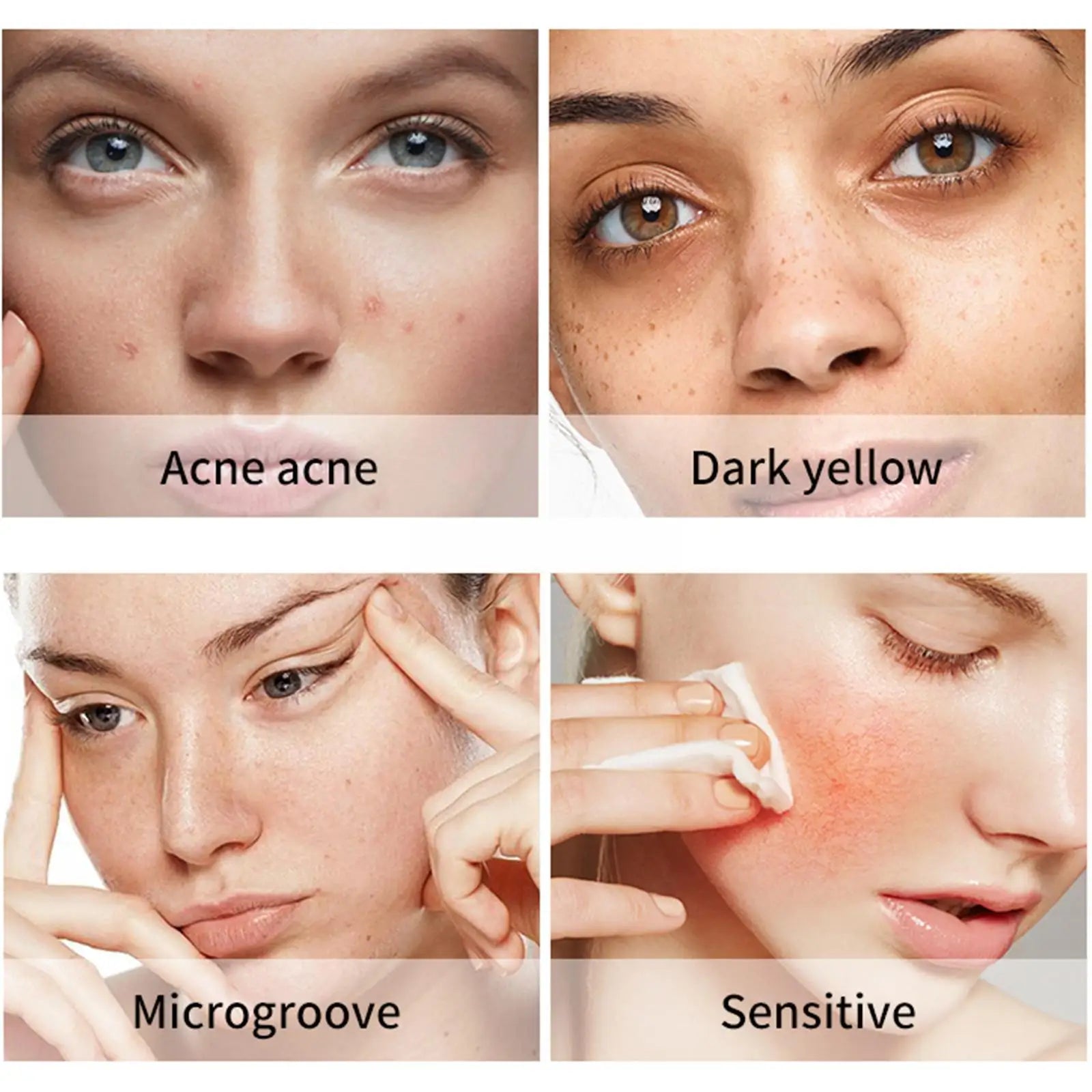 Acne Cleansing Cream Set 5pcs Face Care Sets Turmeric Facial Acne Cleansing Cream Anti-Aging Serum Dark Skin Moisturizing Spots Turmeric Fade O8B2 ShopOnlyDeal