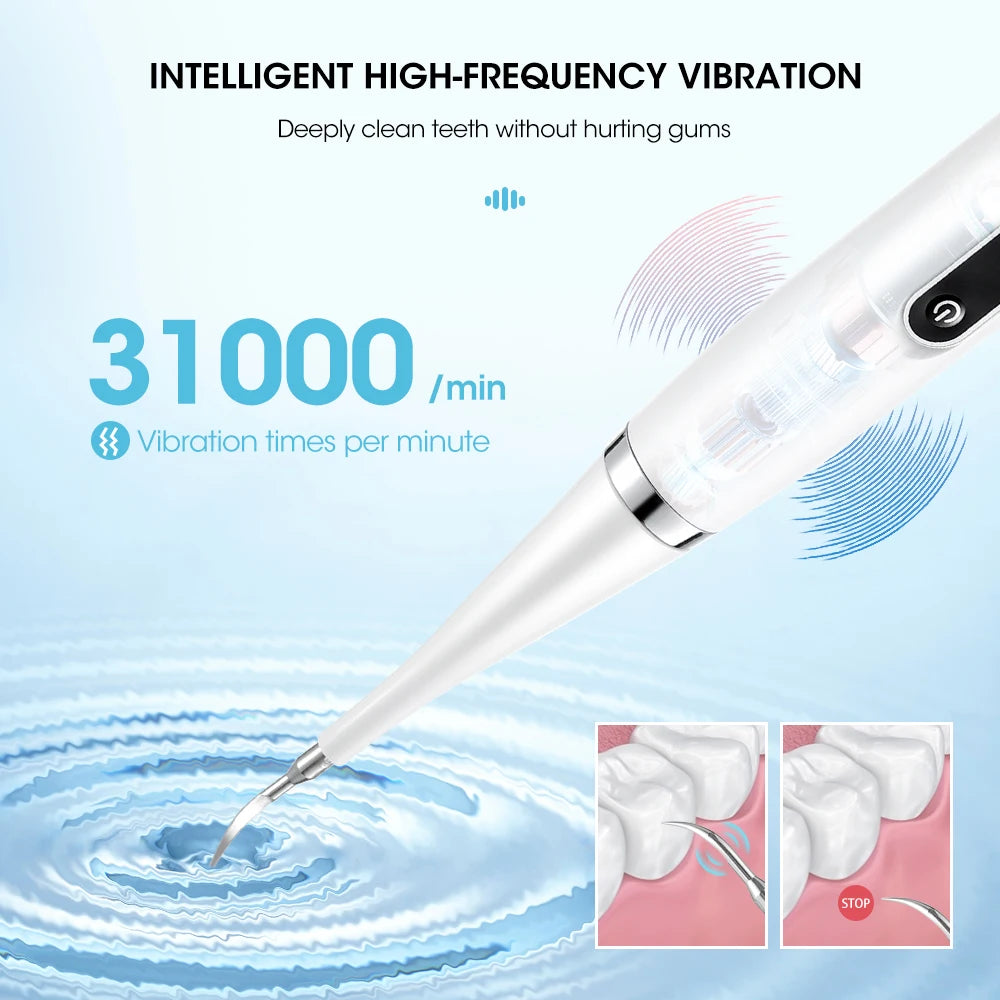 Electric Teeth Whitening Dental Calculus Scaler Plaque Coffee Stain Tartar Removal High Frequency Sonic Toothbrush Teeth Cleaner ShopOnlyDeal
