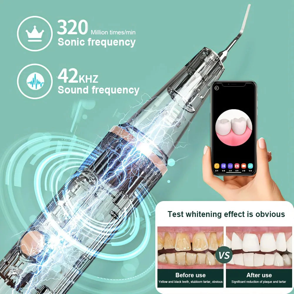 INSMART WIFI Visible Electric Ultrasonic Scaler Tooth Calculus Remover Cleaner Tooth Stains Tartar Whiten Teeth Tool ShopOnlyDeal