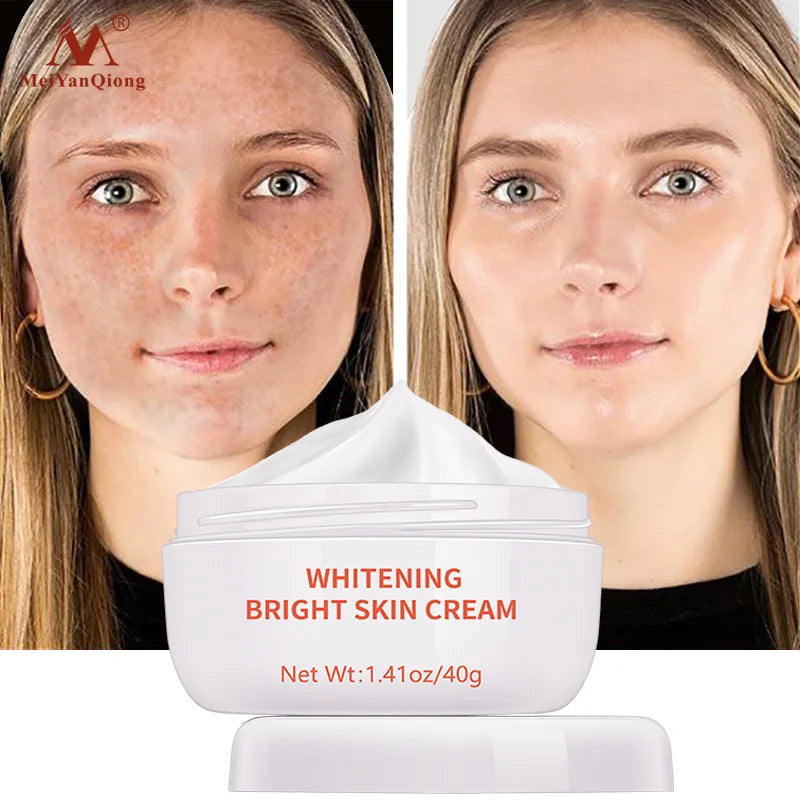 Moisturizer Face Cream Acne Treatment Remove Dark Spots Whitening Bright Skin Cream Face Lift Firming Face Skin Care ShopOnlyDeal