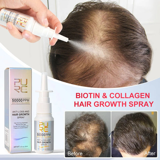 PURC Biotin Hair Growth Products for Men Women Hair Loss Treatment Fast Grow Hair Spray Regrowth Thicken Oil Hair Care ShopOnlyDeal