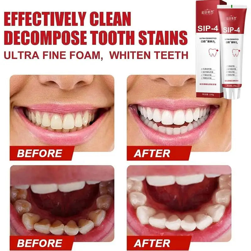 Sip-4 Probiotic Whitening Toothpaste Brightening & Stain Removing Sp-4 Probiotic Toothpaste Fresh Breath Teeth Whiten Toothpaste ShopOnlyDeal