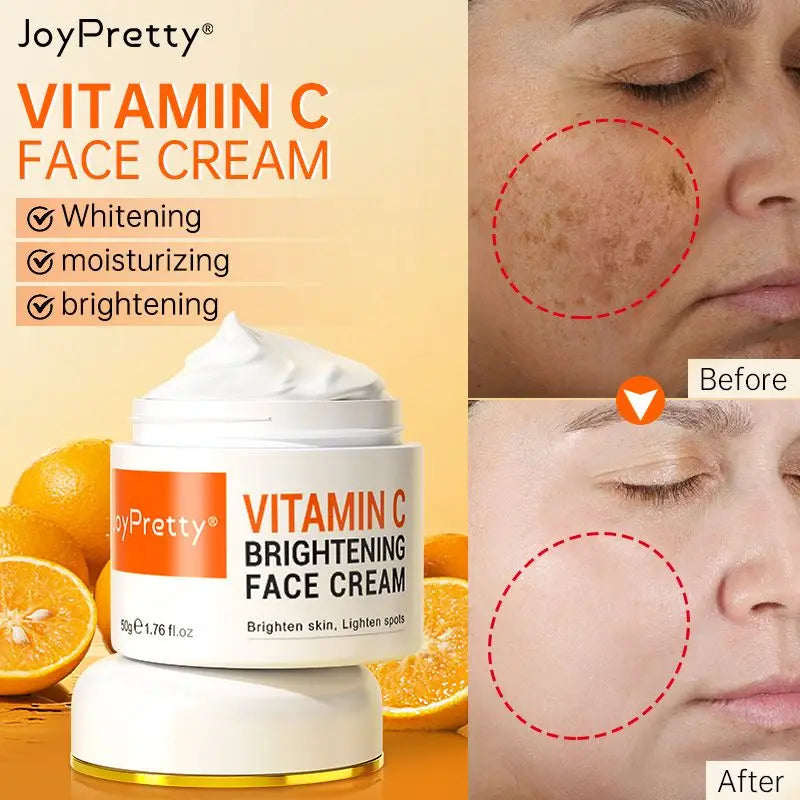 Vitamin C for Face Cream Pigments Dark Spots Removal Whitening Facial Cream Lightening Skin Care Products Beauty Health ShopOnlyDeal