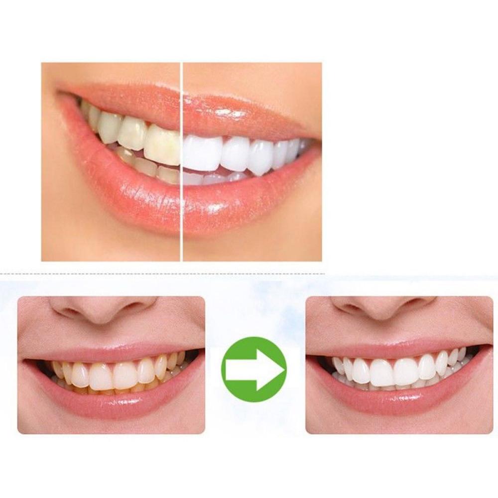 TeethWhite®️ Plus Organic Charcoal Teeth Whitening + 1 PCs Tooth Brush ShopOnlyDeal